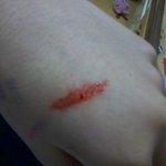 요즘유행하고잇는상처만들기?난틴트로한다