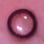 <b>아세톤</b>에 렌즈를 넣으면 커진다 해서 해봤더니......