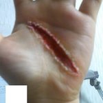 [사진有]상처만들기