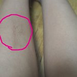 (<b>사진</b> 有) 한쪽다리에만 <b>털</b>이나요 ㅠㅠ (<b>사진</b> 有)