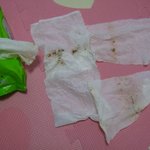 보령물티슈 이정도면 판매<b>중지</b>해야하는거 아닌가요?