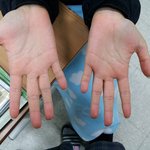 ★★★손가락이 이상해요★★★
