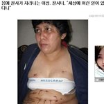 헐 <b>사람몸</b>에서 연가시가 나오네여;