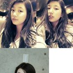 ★미쓰에이 '수지' 성형 아닌 라미네이트 <b>시술</b>~ 정말??