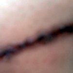 ★★★상처그리기★★★(약간혐오 스압주의)