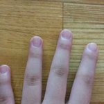 ★<b>손톱</b>이 자꾸 기를수록 휘어요(사진有)