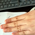 ★★<b>손톱</b>없다는사진 보고 비웃은 우리언니 사진有★★