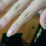 ○●○●(사진有)손톱의 비참한 최후○●○●※고통주의
