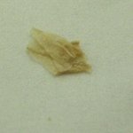 ★★★★★★★떠먹는 비피더스 에서 이<b>물질</b>이 나왔어요 ★★★★★★★★
