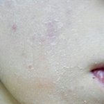 ★★★악건성탈출!!!!!인증샷ㄱㄱ공유해융★★★