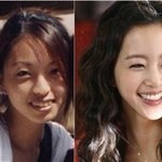 연예인들 <b>치아</b>교정 전vs후 모음
