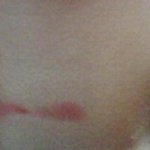 (수정)(사진추가!!!)상해입었습니다!!