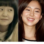 백진희 성형수술 한 건가??