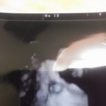 사진有)) 저도 출산후기 한번 써보렵니다 !ㅎ