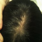 ★☆3500원짜리 <b>매직약</b>의 위엄☆★