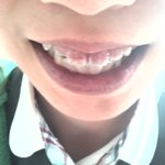 ☆★☆★(사진有)치아<b>미백</b>?ㄴㄴ천연치아틴트!! ☆★☆★