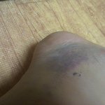 ☆★☆★이런상처그릴수있는사람들어와바☆★☆★