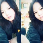 사진多 눈 쌍수하고싶은데요..ㅠㅠ