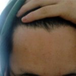 이마 <b>만주</b> 벌판임ㅋㅋㅋㅋㅋㅋㅋㅋㅋ나처럼 이마 넓은 사람 있슴ㅇㅇ...