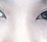 (사진 有)눈 <b>수술</b> 한거 같나요??
