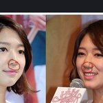 ★★★이런코가진사람없나요?ㅜㅠㅠㅜㅠㅜ★★★