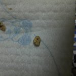 해바라기초<b>코볼</b>에서 돌이나왔어요.