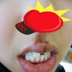 ★★(사진有) 저 어떻게 <b>살아요</b>? 폭행(?)의 흔적★★