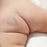 이 아기처럼 몽고<b>반점</b> v자였던 분들 또 있어여?ㅋㅋㅋㅋㅋ