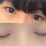 쌍수를 해야할까요 요런눈-_ㅠ