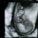 남자는머리빨이라더니ㅠㅠㅋㅋㅋㅋㅋ★★★사진마늠,스압★★★