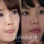 아이유 신봉선 이게 안닮았다고?????