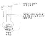 ★★★★ <b>성장판</b> 열렸는지 닫혔는지 제대로 확인 ★★★