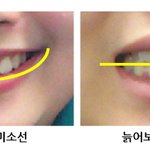 ★치아교정으로 용된 女연예인 <b>best</b> 5! ★