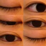 아 <b>요새</b> 쌍수는 티도 안나냐?