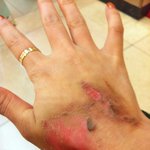 여자의 손이 이렇게 됐습니다(사진有)