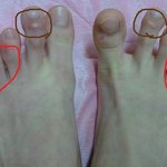 수정햇습니다! ★사진잇어요!!!!!!!부끄럽지만ㅠㅠ 혐오주의.....