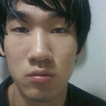 <b>사진</b>있어요 외모때문에 정말 죽고싶을<b>정도</b>로 고민..