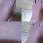 <b>손</b>이 너무 징그러워요...(<b>사진</b>有)