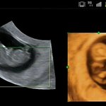 둘째 <b>따님</b> 초음파 사진 자랑하고 가요 ㅎㅎ