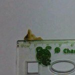 ★★★★★[사진有] 귀에서 <b>고막</b>이 떨어졌어요!!!★★★★★