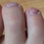 (혐오)<b>발톱</b>이......................