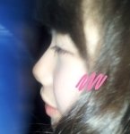 들린 <b>코</b>는 <b>코</b> 수술 하면 이상해져요? <b>옆</b>사진있음!