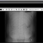 *****불쌍한 내 동생**********이것이 적절한 처치엿을까요...