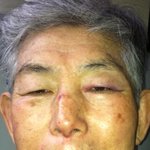 할아버지 때린놈 글쓴이 입니다 그놈이 할아버지를 또 <b>폭행</b>했습니다