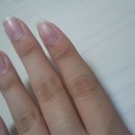 제 <b>손톱</b> 좀 봐주세요ㅠㅠㅠ