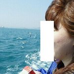 (사진有/혐오有) 여드름년이랑 11개월 싸워서 이겼어요ㅠ^ㅠ