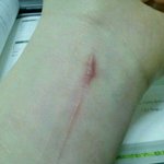 사진有)친구가 <b>자해</b>를 하는데...