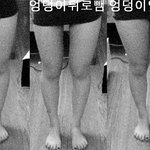 [<b>혐오사진</b> 有 &amp; 답정너 無] 제 다리가 <b>혐오</b>스러운가요