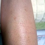 ★★(<b>사진</b>有)★★★언니들제<b>다리</b>피부어떻게하죠ㅠㅠ?★★★★★★