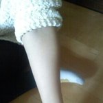 ★★★★★★★★제친구의팔을도와주세요!!!!★★★★★★★